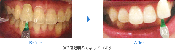 Before After ※3段階明るくなっています